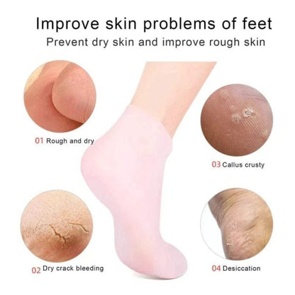 Silicone Anti Cracking Moisturizing Gel Socks (1 Pair)